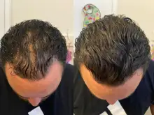 Customer result photo
