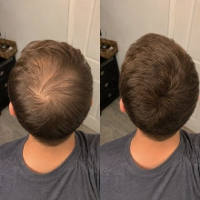 Customer result photo