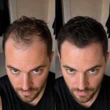 Customer result photo