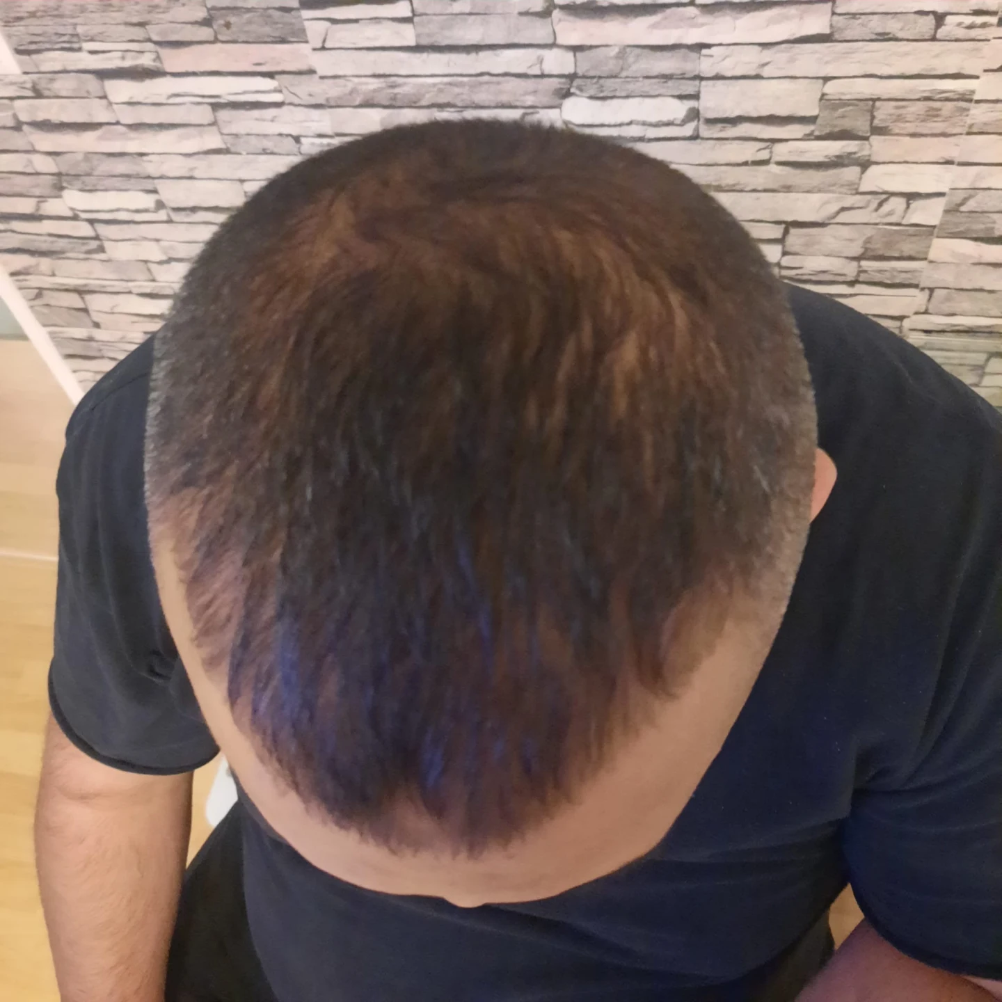 【超まとめ買い】E-STANDARB HAIR SERUM 12本入り 41MCkqKYWUL.jpg_BO30,255,255,