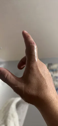 0