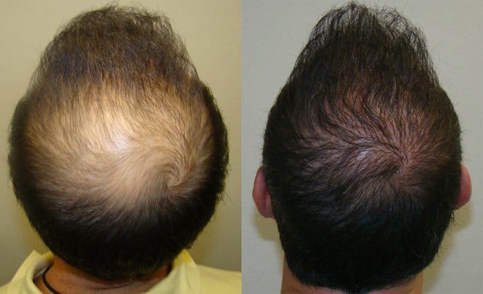 Scalpiere Scalp and Hair Therapy